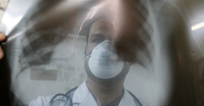 Sağlık Bakanlığı raporuna göre bu kışın belası 'gergedan virüsü'