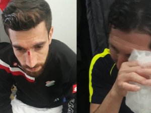 Cizre Spor'a saldırı: Oyuncular darp edildi