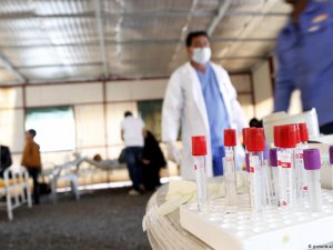 Yemen'de iki buçuk ayda 109 bin kolera vakası