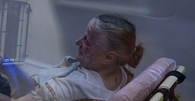 İspirto ile felçli eşini ve kendisini yaktı