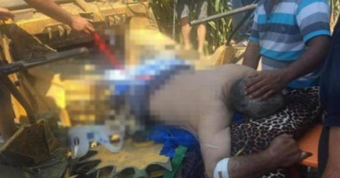 Telefonla konuşurken bacaklarını biçerdövere kaptırdı