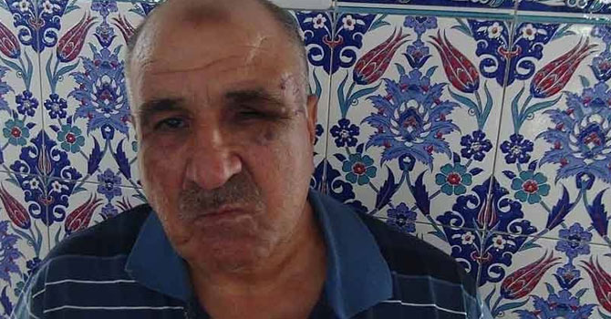 Duayı beğenmeyip imamı dövdüler