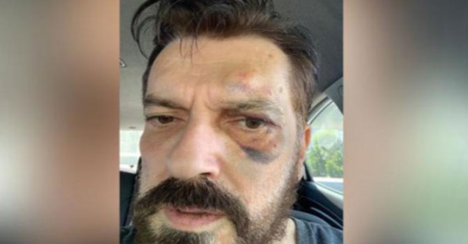 Ünlü anket şirketi sahibine saldırı