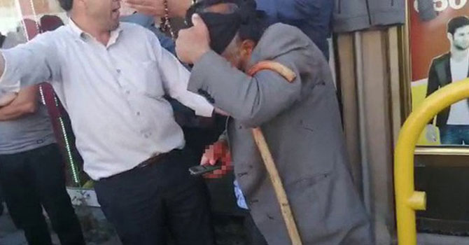 Ağrı'da muhtarlık kavgası: 7 yaralı