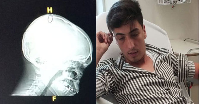 Bayram namazından çıktı; kanlar içinde yere yığıldı! Görenler yardıma koştu