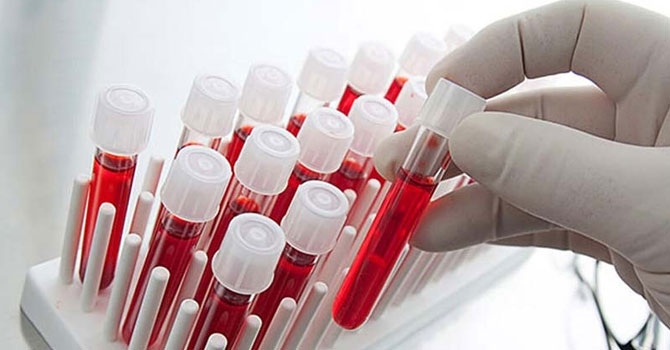 Kansere karşı en dirençli kan grubu belli oldu