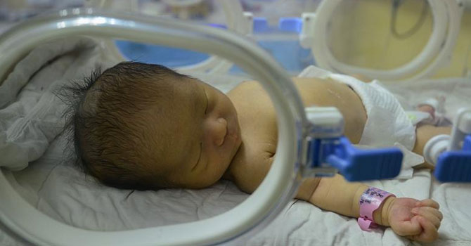 Çekya: Beyin ölümü 117 gün önce gerçekleşen kadın doğum yaptı