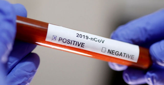 Türkiye'de koronavirüs kaynaklı can kaybı 131'e çıktı