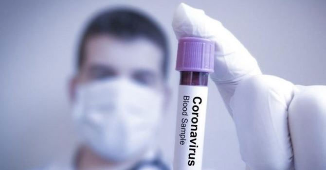 Koronavirüs en çok hangi kan grubunda görülüyor?