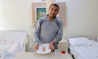 Böbreğinden 95 taş çıktı