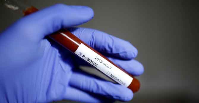 Koronavirüsün yeni belirtileri açıklandı