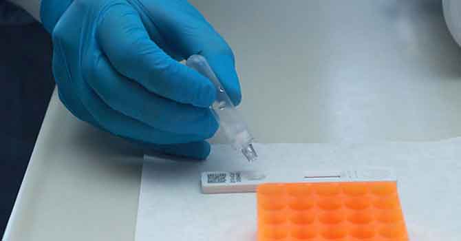 15 dakikada sonuç veren tanı kiti devrede