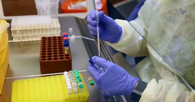 Bosch hızlı koronavirüs testi geliştirdi