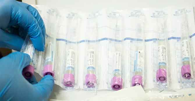 Rusya: Koronavirüsü tedavi edecek ilaç geliştirildi