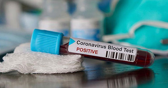 Fahrettin Koca: Bugün 56 can aramızdan ayrıldı