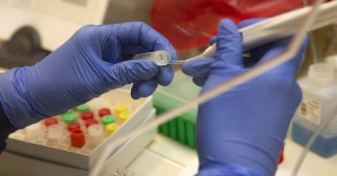 İngiltere'de 'beş dakikada sonuç veren' koronavirüs testi deneniyor