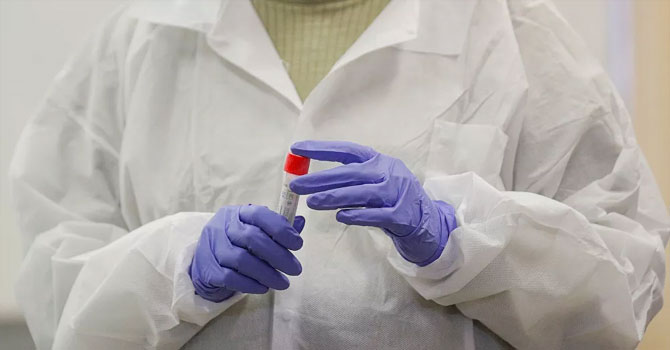 Son 24 saatte 1.572 yeni vaka, 47 ölüm