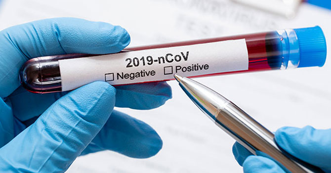 Dünya genelinde ölü sayısı 244 bin 791’e yükseldi