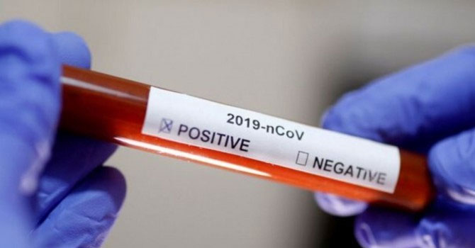 Dünya genelinde can kaybı 340 bin 47’ye yükseldi