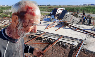 Arazi tartışmasında demir çubuklu dehşet