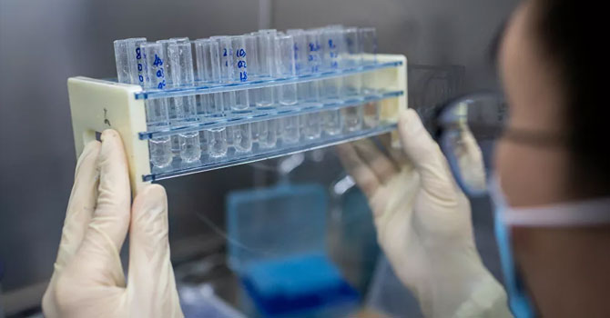 DSÖ: Kovid-19'a yakalananların büyük kısmında hastalık ağır seyrediyor