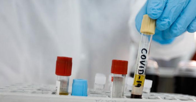 ABD'deki aşı deneyinde ilk sonuçlar olumlu