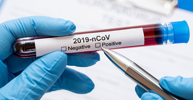 Dünya genelinde koronavirüs bilançosu: Can kaybı 334 bin 680’e yükseldi