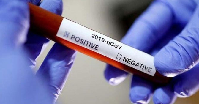 Covid-19 nedeniyle sosyal hizmetler merkezi kapatıldı