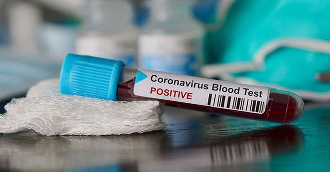 Türkiye'de son 24 saatte 19 kişi hayatını kaybetti