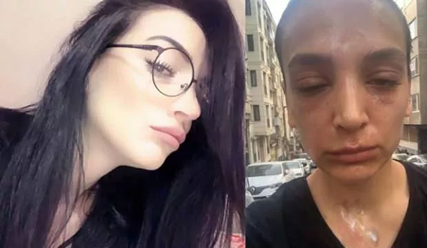 Lavabo çözücü bomba gibi patladı