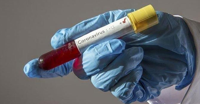  Vaka sayısı 12 milyona yaklaştı