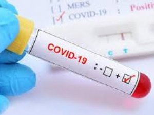 Bakan Koca son 24 saatin verilerini açıkladı