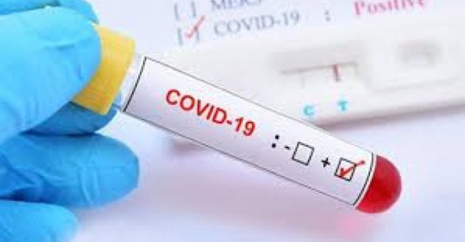 Bakan Koca son 24 saatin verilerini açıkladı