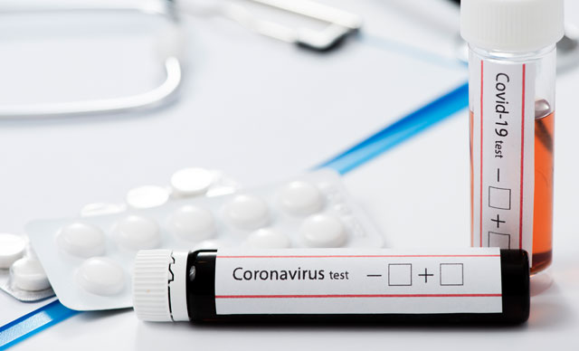 Dünya genelinde koronavirüs bilançosu: Can kaybı 446 bin 184’e yükseldi