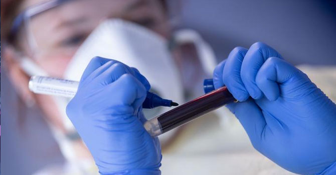 Araştırma: COVID-19'un seyrinde kan grubu rol oynuyor