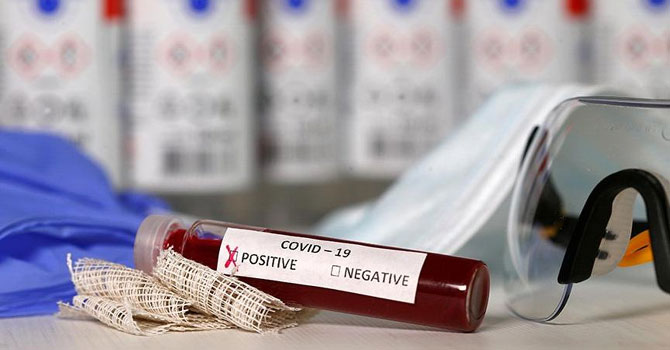 Araştırma sonucu A kan grubundakileri korkuttu