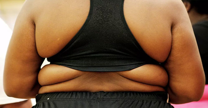 Obezite ameliyatlarında yeni düzenleme