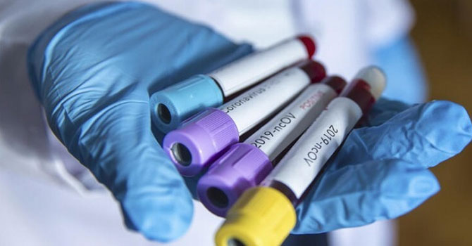 Prof. Dr. Müftüoğlu: Ülkemizde şu anda en az 200 bin virüs taşıyıcısı var