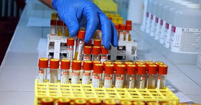 Türkiye'de son 24 saatte 16 kişi öldü