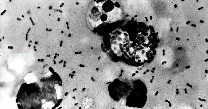 Rus virolog, hıyarcıklı vebanın yayılma riskini değerlendirdi