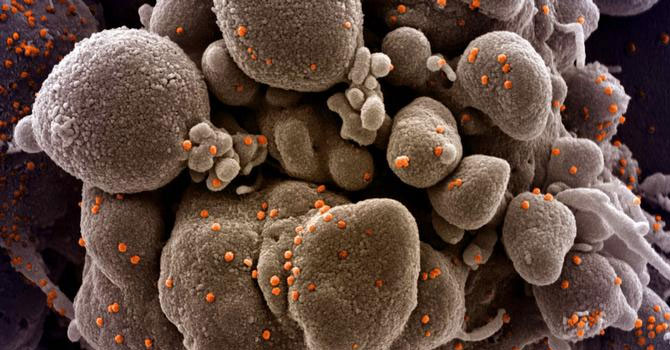 Korona virüsü salgını: Türkiye'de 113 kişi daha öldü