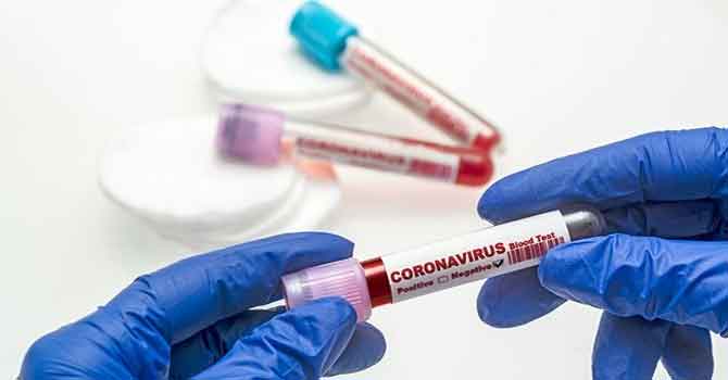 Bilanço ağırlaşıyor, can kaybı 841 bin 372’ye yükseldi