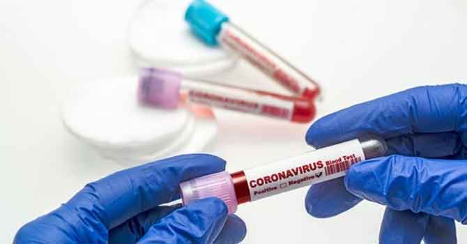 Son 24 saatte 72 kişi hayatını kaybetti