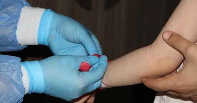 Bakan Koca duyurdu: Bileklik uygulaması geliyor