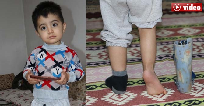 Hakkarili Minik Mahir yardım eli bekliyor