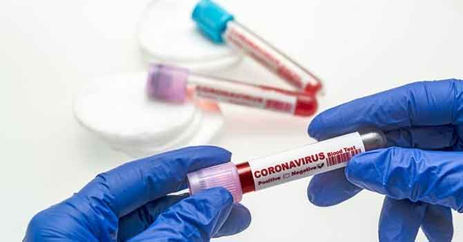 Sağlık bakanlığı 15 Şubat verilerini açıkladı