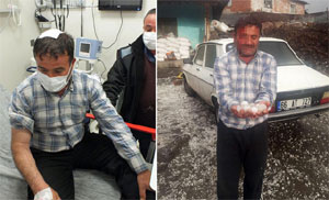 Ceviz büyüklüğündeki dolu hastanelik etti