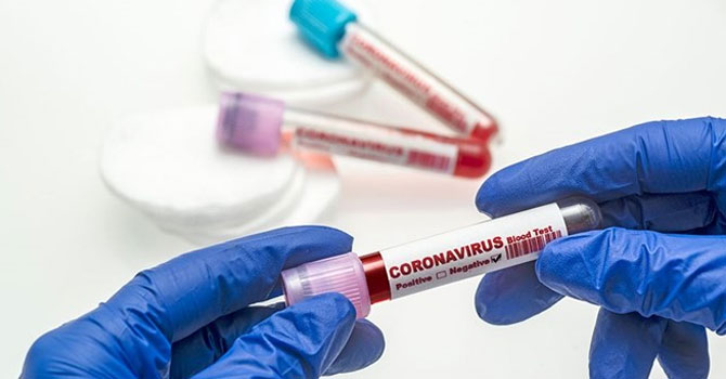 Türkiye'de son 24 saatte  318 kişi hayatını kaybetti