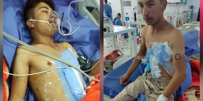 Derecik’te vurulan Ekinci: Bizi görüyorlardı, biliyorlardı