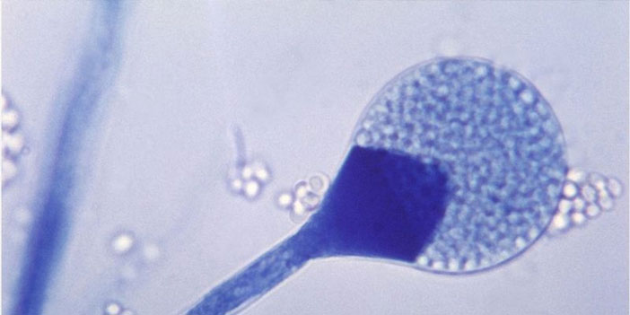 Kara mantar hastalığı